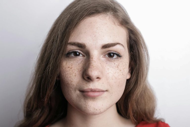 comment enlever les taches de rousseur